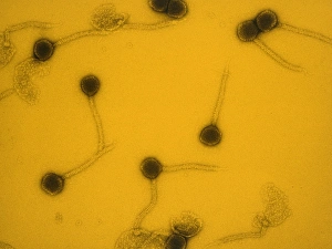Virology Images Imprime: False-col TEM of Lambda bacteriophages