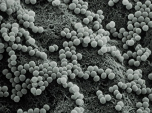Staphylococcus Aureus Bacteria Imprime: False-col TEM of Staphylococcus aureus