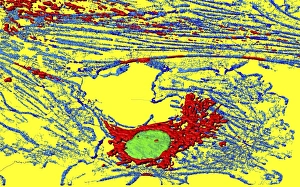 Mitochondria Energy Production Imprime: Fibroblast cell, fluorescent micrograph