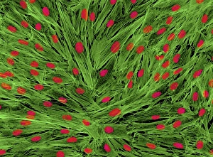 Light Micrograph Images Imprime: Fibroblast cells, light micrograph