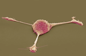 Coloured Scanning Electron Microscopy Imprime: Fibroblast, SEM