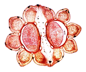 Light Microscopy Images Imprime: Fools parsley fruit, light micrograph