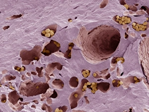 Scanning Electron Microscope Images Imprime: Fossilised compact bone, SEM