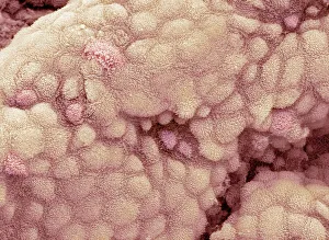 Coloured SEM Images Imprime: Gallbladder surface, SEM