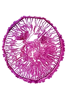 Light Micrograph Imprime: Gem anemone, light micrograph