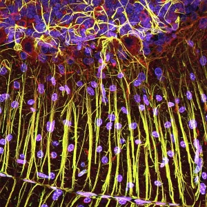 Cerebellum Micrograph Imprime: Cerebellum tissue, light micrograph