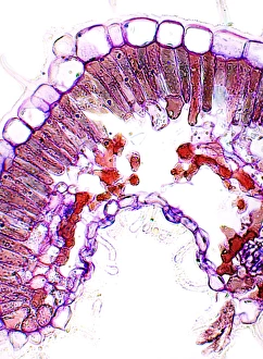 Drought Resistant Plants Imprime: Heather leaf, light micrograph