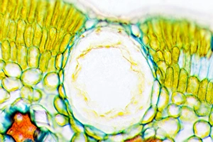 Drought Resistant Plants Imprime: Heather leaf stomata, light micrograph