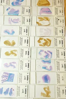 Impresiones de Las hojas de microscopio del cerebro humano. Hojas de microscopio estandarizadas con secciones estainidas del cerebro humano provenientes del Centro de Recursos Cerebrales y Tissue Harvard, EE.UU Imágenes fechadas en 2006: Microscopio de cerebro humano
