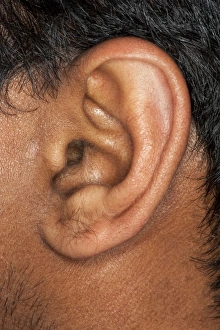 Human Ear Anatomy Imprime: Human ear C013 / 7319