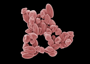 SEM Images Of Pollen Imprime: Hypericum pollen