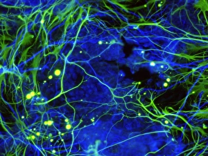 Células estaminales nerviosas inducidas en micrografía