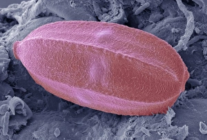 Coloured SEM Images Imprime: Insect egg, SEM