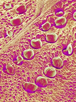 Scanning Electron Micrograph Insects Imprime: Insect exoskeleton, SEM