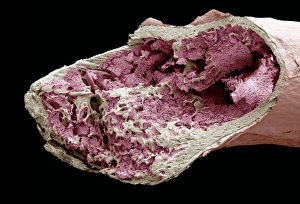 Imágenes fechadas en abril de 2007: Interior de una hueso, SEM
