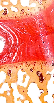 Spine Anatomy Imprime: Intervertebral disc, light micrograph