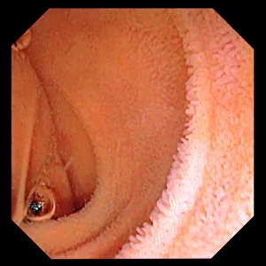 Imágenes fechadas en abril de 2012: Manto intestinal