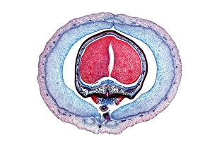 Light Microscopy Images Imprime: Kidney bean, light micrograph