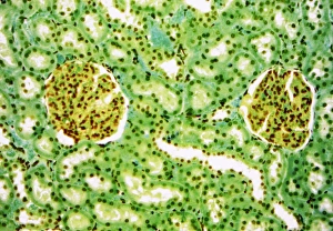 Imágenes de octubre de 2007: Glomérulos renales, imagen de microscopio ligero