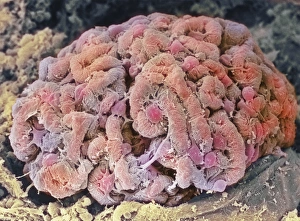 Impresiones de Glomerulus. Micrografía de escaneo electrónico colorida (SEM) del glomérulo sano del riñón. El glomérulo es una pelota apretada de capilares donde pasa el sangre a través de los riñones se filtra Imágenes de 2000: Glomérulo renal de niño