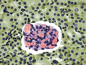 Impresiones de El glomerulo del riñón. Micrografía de luz coloreada de una sección a través de la corteza sano del riñón, mostrando un glomerulo Imágenes de diciembre de 2008: Glomérulo renal, imagen de microscopio ligero