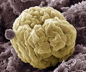 Impresiones de Glomero de riñón, imagen del escaneo electrónico de color bajo el microscopio electrónico (SEM). Las células podocito que componen la superficie del glomero son amarillas Imágenes de mayo de 2008: Glomero de riñón, SEM