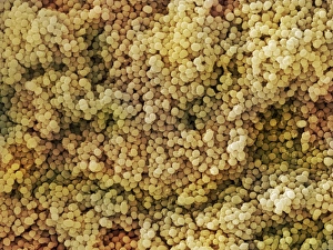 Scanning Electron Micrograph SEM Imprime: Lactococcus sp. Bacteria (SEM)