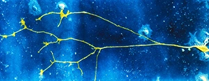 Human Nervous System Anatomy Imprime: Light micrograph of a nerve cell