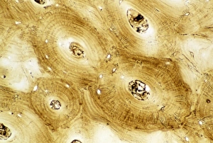 Impresiones de La micrografía de luz de una sección transversal del tejido óseo compuesto normal humano, tal como lo encuentra en las astas de los huesos largos como el fémur Imágenes de octubre de 2003: Micrografia de luz de hueso humano compuesto normale