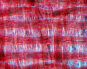 Light Microscopy Images Imprime: Light micrograph of polyamide in tissue