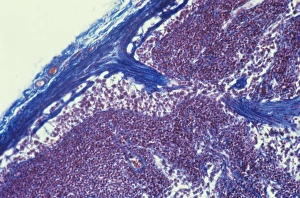 Human Immune System Cells Imprime: Lymph node, light micrograph C015 / 6222