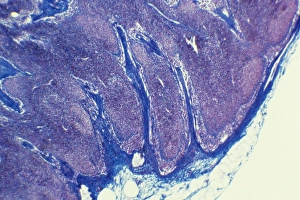Immune System Cells Imprime: Lymph node, light micrograph C015 / 6223