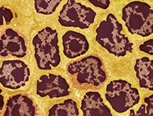 Immune System Cells Imprime: Lymph node, TEM