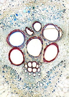 Estroma óseo de hueso en micrografía ligera