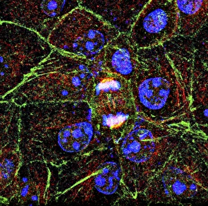 Cell Division Imprime: Mitosis, fluorescence micrograph