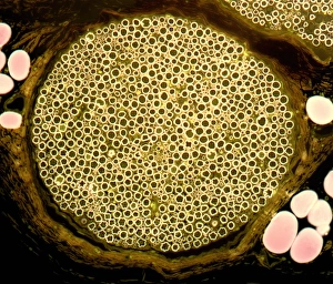 Myelin Sheath Structure Imprime: Nerve bundle, light micrograph