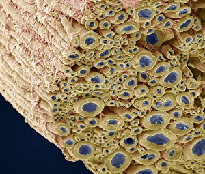 Myelinated Nerve Fibres Imprime: Nerve bundle, SEM