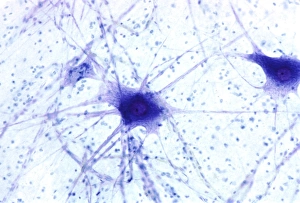 Nerve Cells Imprime: Nerve cells, light micrograph
