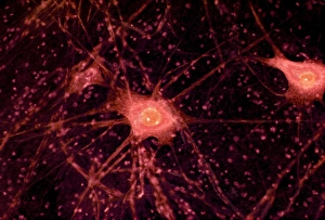 Imágenes de julio de 2008: Células nerviosas, micrografía de luz