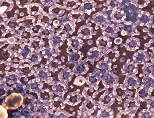 Impresiones de Complejos de poro nuclear: micrografia escaneada con color del SEM sobre la superficie del núcleo celular mostrando el numeroso complejo de poros nucleares (NPCs, anillos) en su envoltura Imágenes fechadas en marzo de 2009: Complejos de poro nuclear, SEM