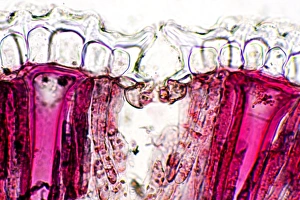 Polarised Light Microscopy Images Imprime: Pincushion leaf, light micrograph