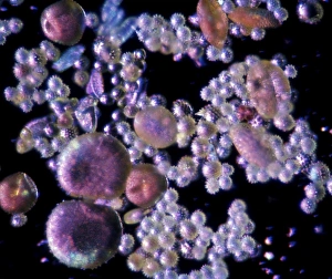 Pollen Grain Morphology Imprime: Pollen, light micrograph