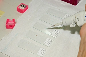 Impresiones de Preparando hojas de polen para su observación bajo un microscopio óptico, fotografadas en la Universidad de Haifa Imágenes fechadas en diciembre de 2011: Preparando el cinta de polen para la muestra