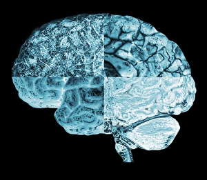Neurology Images Imprime: Quartered brain