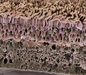 Scanning Electron Micrograph SEM Imprime: Retina, SEM