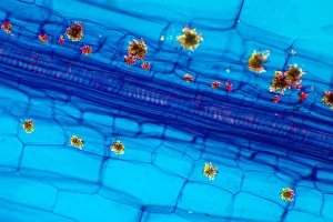 Polarised Light Microscopy Imprime: Rhubarb leaf, light micrograph