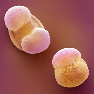 Impresiones de Pollen de pino escocés. Micrografía electrónica de escaneo coloreada (SEM) del poleno de Pinus sylvestris Imágenes fechadas en marzo de 2009: Pollen de pino escocés, SEM