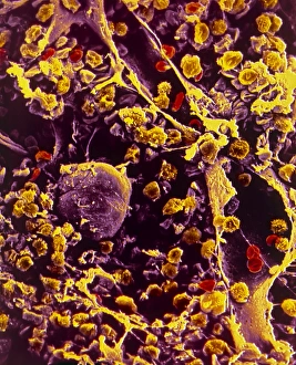 Human Body Bone Structure Imprime: SEM of bone marrow