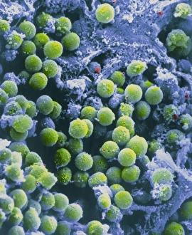 Human Immune System Cells Imprime: SEM of lymphocytes in cortex of thymus