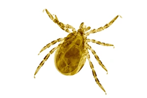 Light Micrograph Imprime: Sheep tick, light micrograph